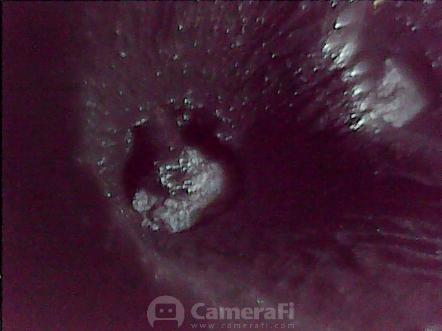 Dióhéjas tisztítás